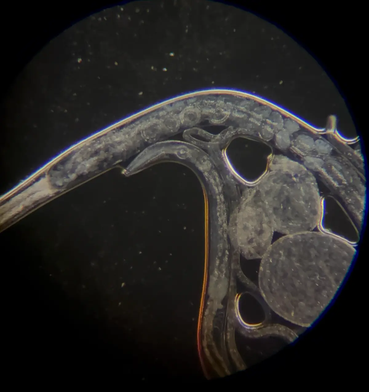 Live Microworms in Potato
